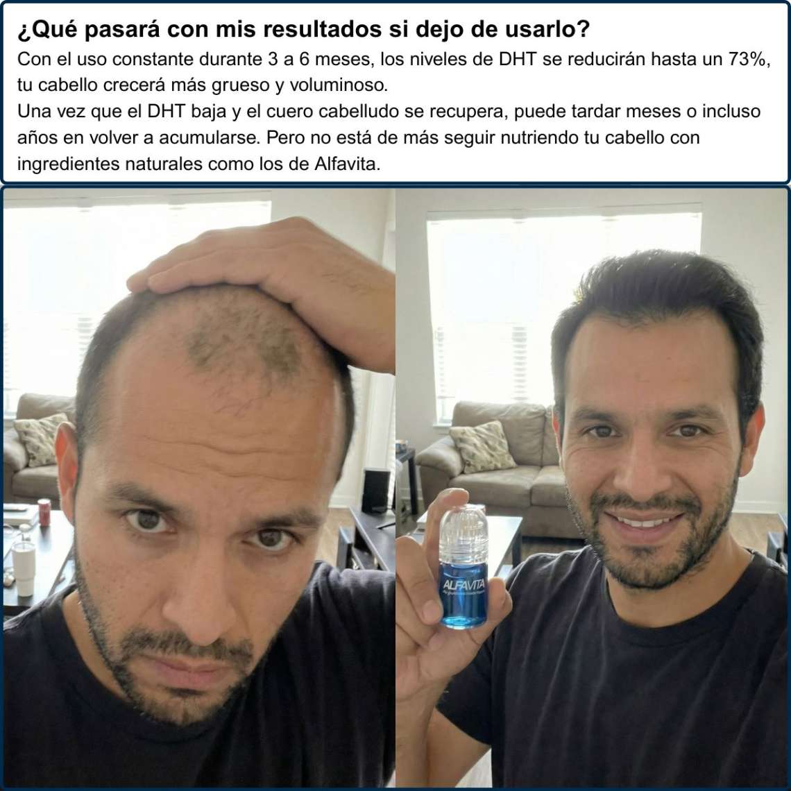 Antes y después — cliente AlfaVita