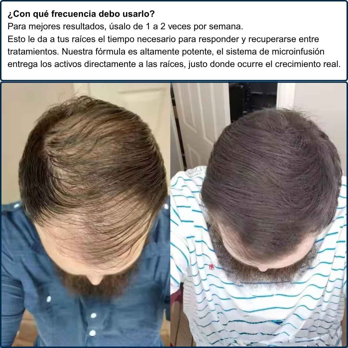 Antes y después — crecimiento AlfaVita